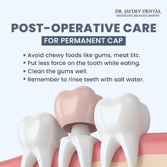 Clove Dentistry in Dwarka: Do You Really Need It? This Will Help You Decide!