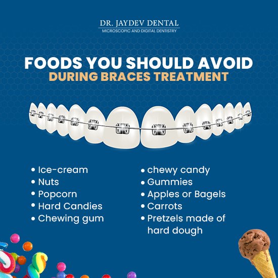 food-to-avoid-while-on-braces