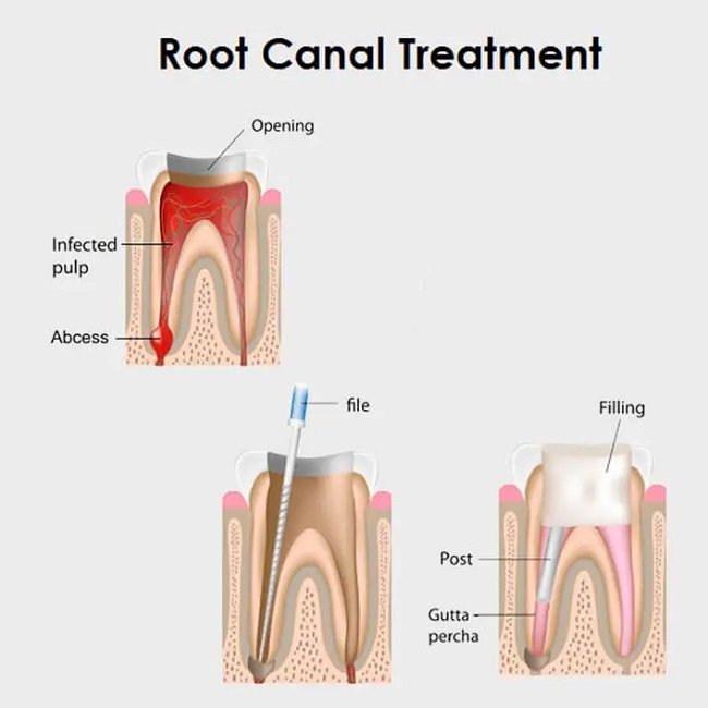 How Our Treatments Transformed Smiles Drdr Jaydev Dental Clinic