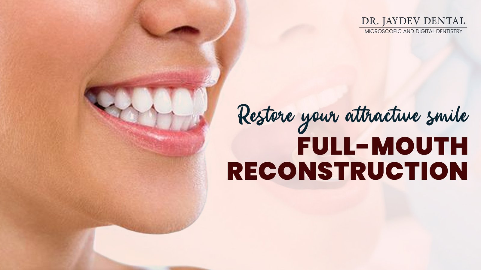 Restore Your Attractive Smile â€“ Full Mouth Reconstruction