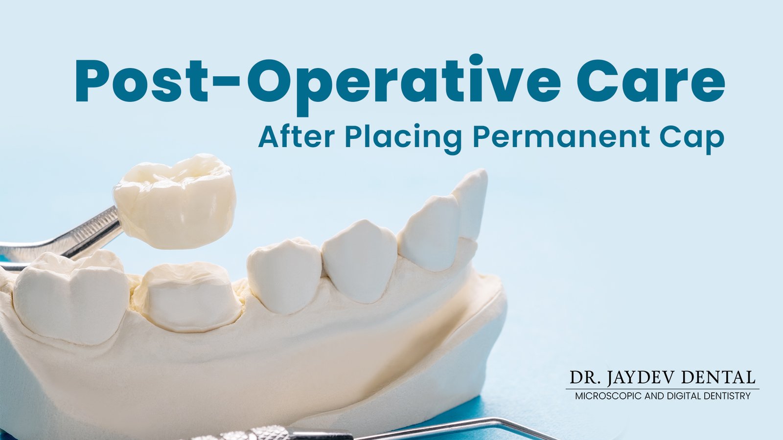 Post-Operative Care - After Placing Permanent Cap