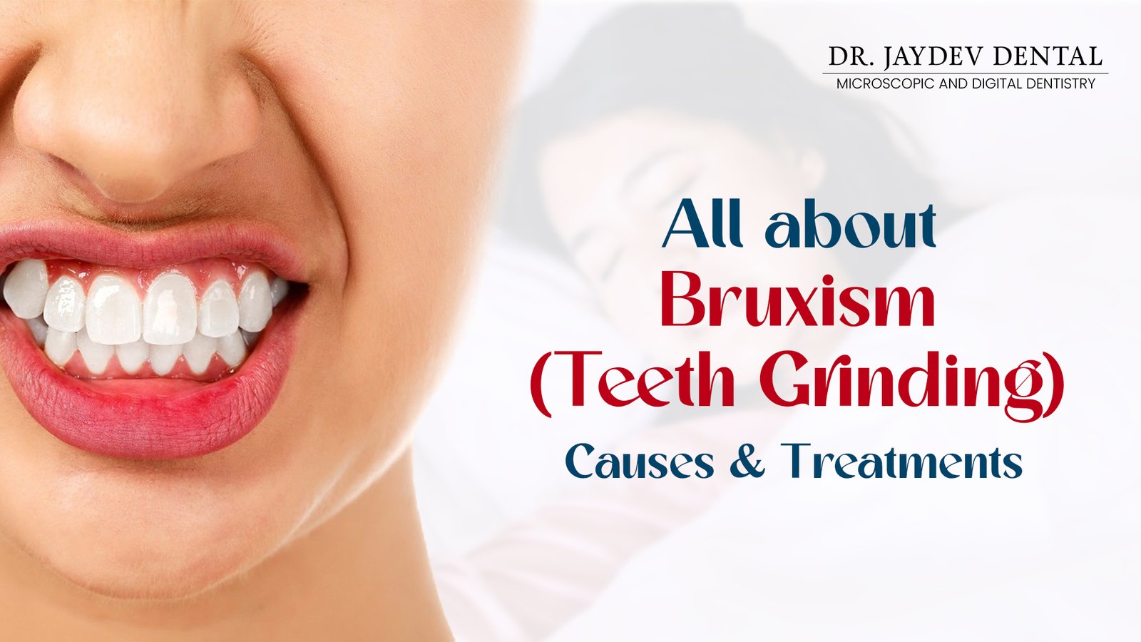 What is Teeth Grinding (Bruxism) - Causes & Treatments 