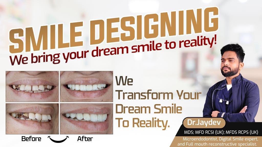 Enhancing Smiles with Smile Designing