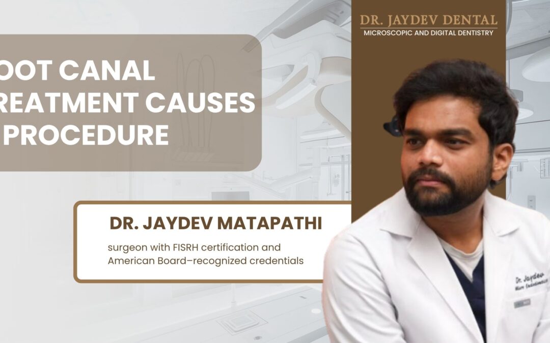Banner about root canal treatment causes and procedure; features Dr. Jaydev Matapathi in a clinical portrait on the right.