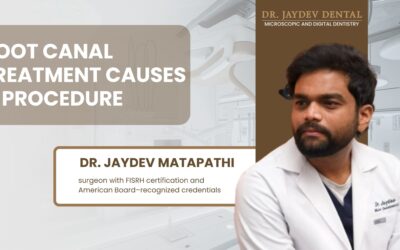 Root Canal Treatment & Causes