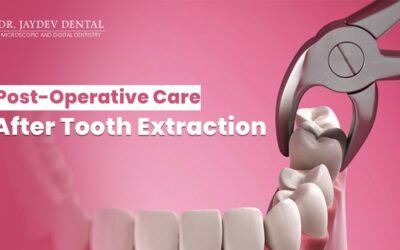 Post Operative Care – After Tooth Extraction