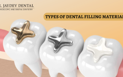 Types of Dental Filling Material & Which is the Best Filling Material