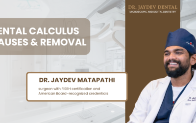 What causes Calculus? Removal and Preventive measures