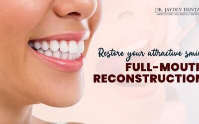 Restore Your Attractive Smile â€“ Full Mouth Reconstruction