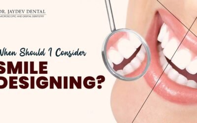 When Should I Consider Digital Smile Designing?