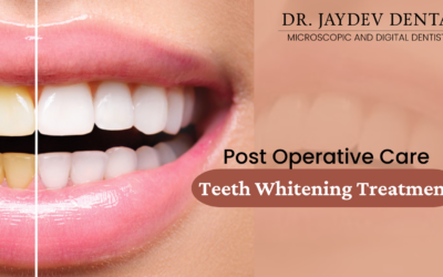 Post Operative Care – Teeth Whitening Treatment