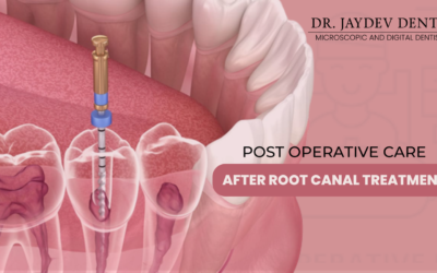 Post Operative Care – After Root Canal Treatment