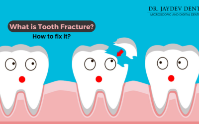 What is Tooth Fracture? How to fix it?