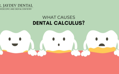 What causes Calculus? Removal and Preventive measures