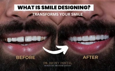 What is Smile Designing? All about Smile Designing