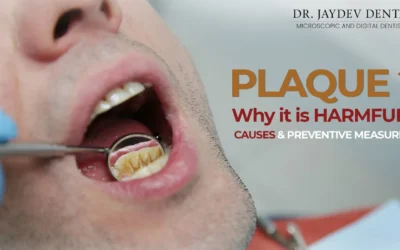 What is Dental Plaque? Why it is Harmful? Causes & Preventive measures