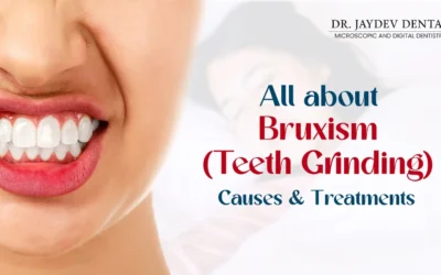 What is Teeth Grinding (Bruxism) – Causes & Treatments