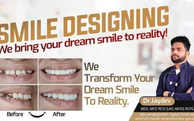 Enhancing Smiles with Smile Designing