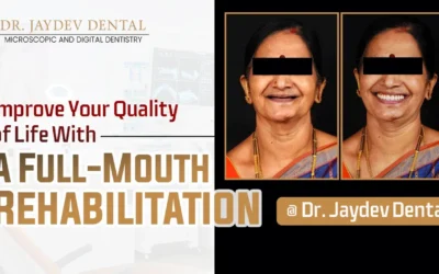 Improve Your Quality of Life With A Full-Mouth Rehabilitation