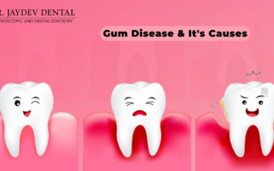 What is Gum disease? What causes Gum disease?