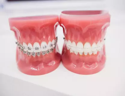 ceramic-braces