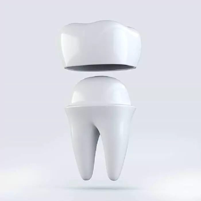 dental-caps-treatment-drjaydev