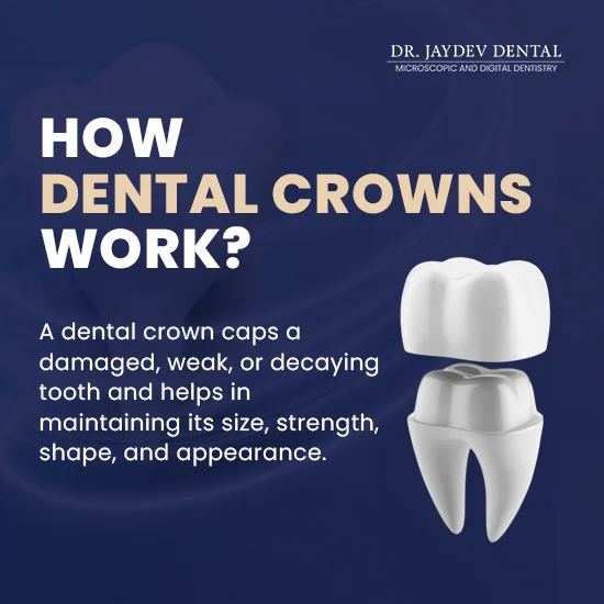 dental-crown-working