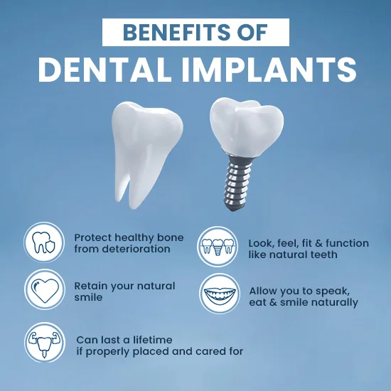 dental-implants-benefits