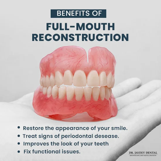 full-mouth-reconstruction-benefits