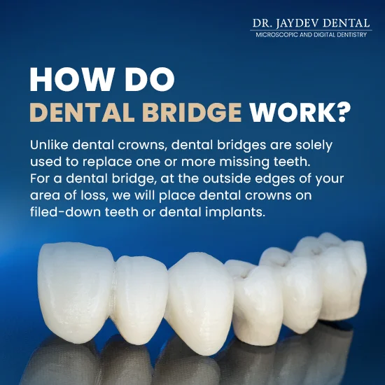 work of dental bridge