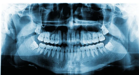 Imaging Techniques