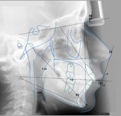 Orthodontic Analysis