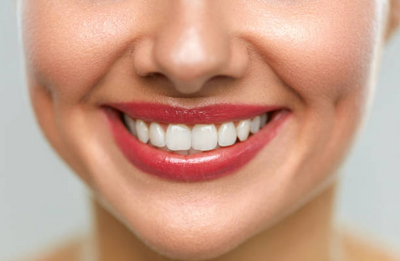 Why Dental Implants and Veneers Are Popular Among Celebrities