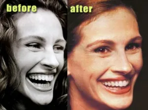 Julia-Roberts | Jaydev Dental Julia Roberts