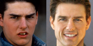 Tom Cruise