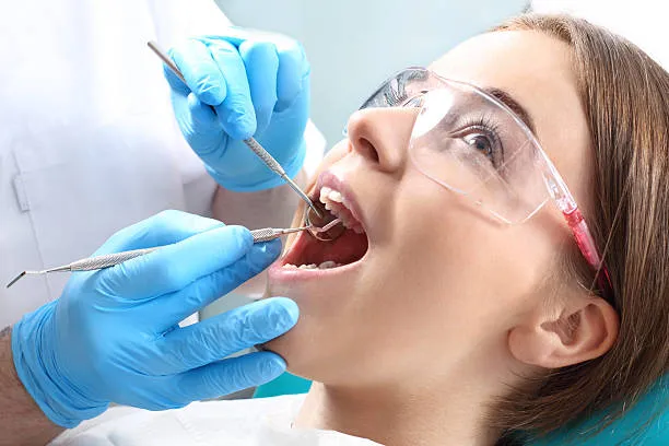 Cracked tooth syndrome after root canal Cracked tooth syndrome after root canal