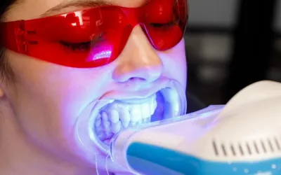 2._In-Office_Professional_Whitening