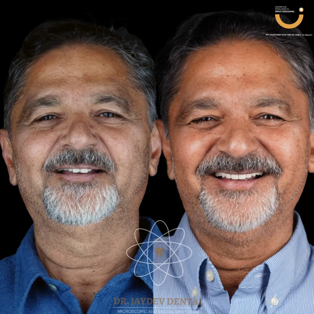 Patient-Before-After-3 Patient-Before-After-3