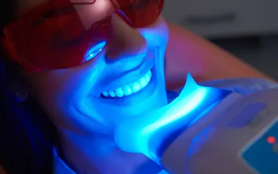 Laser Teeth Whitening