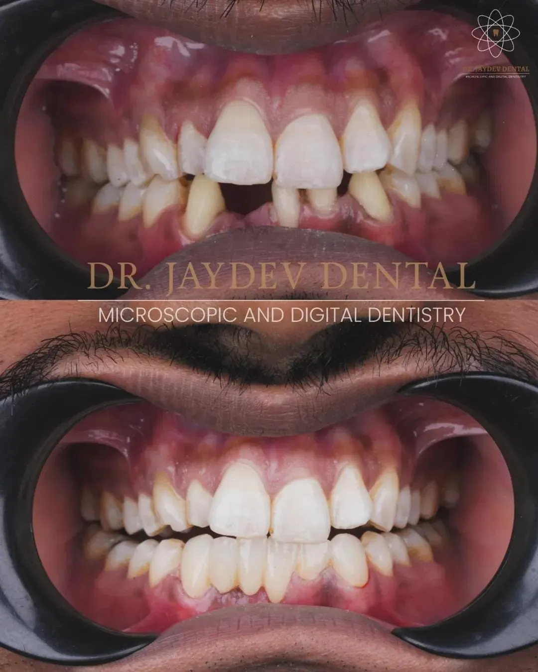 WhatsApp Image 2025-06-11 at 083943 1 1 img4