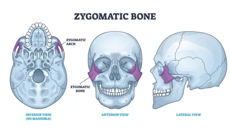 zygomatic-bone
