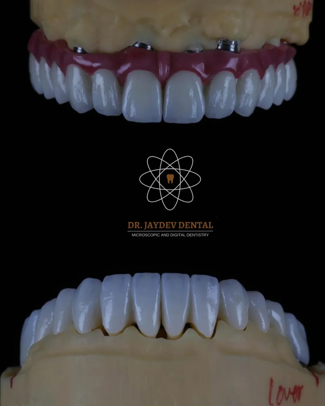 The name behind true premium care Dr Jaydev Dentaldentalclinicinhyderabad JaydevSmileMake 1 Untitled_design_21 2