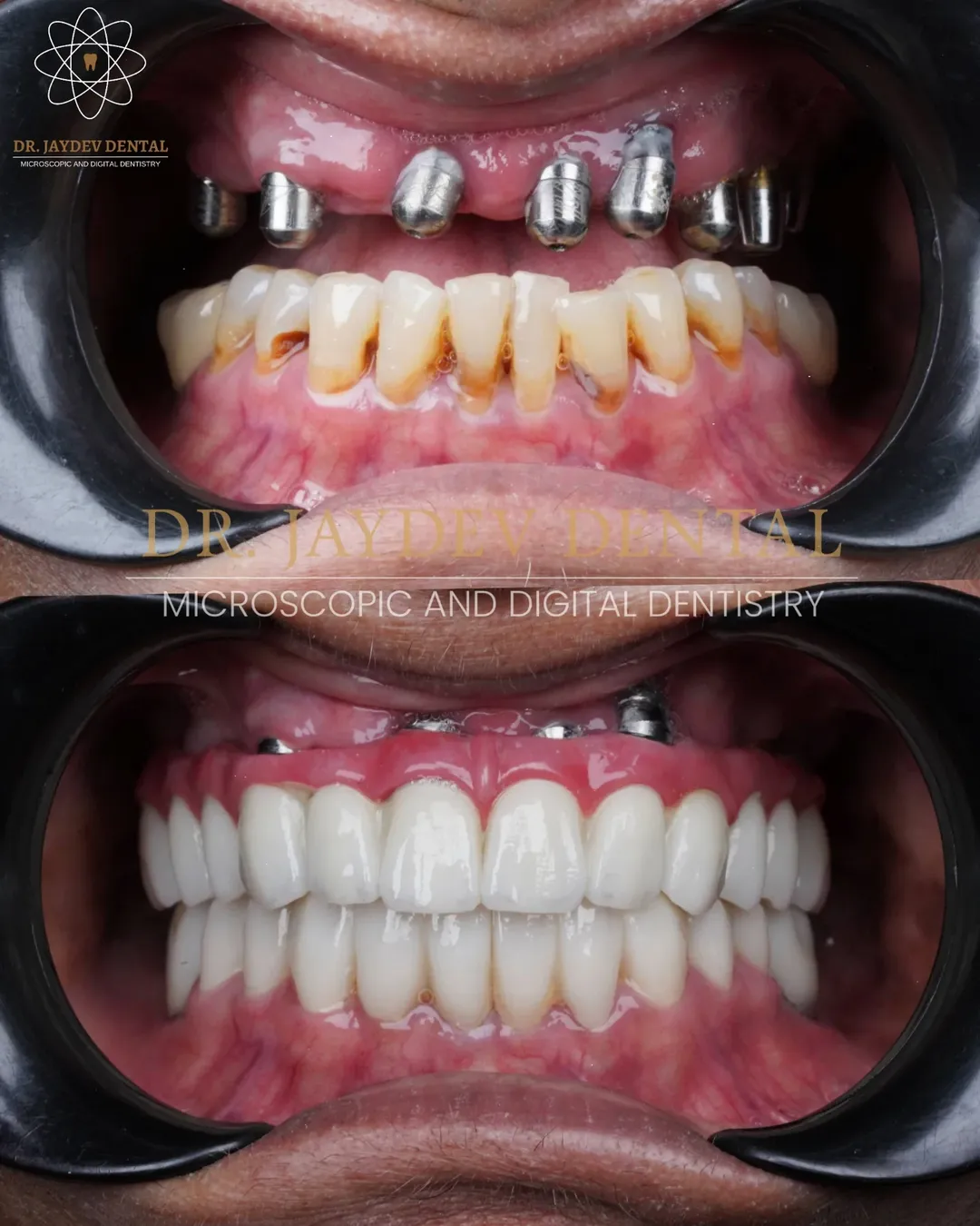 The name behind true premium care Dr Jaydev Dentaldentalclinicinhyderabad JaydevSmileMake 3 img1