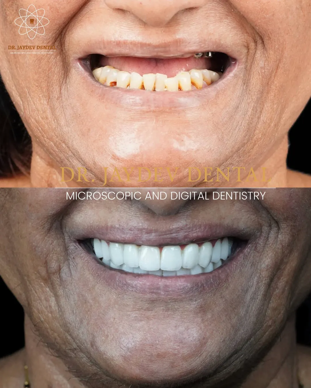 The name behind true premium care Dr Jaydev Dentaldentalclinicinhyderabad JaydevSmileMake ds1