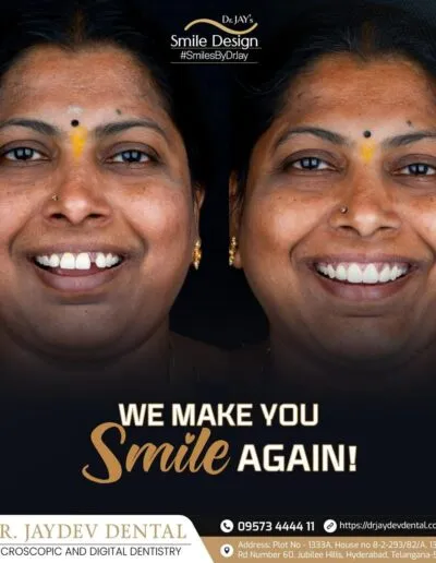 smile-makeover-before-after