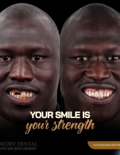 smile-makeover-before-after