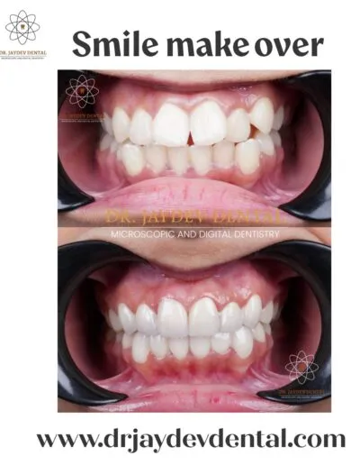 smile-makeover-before-after