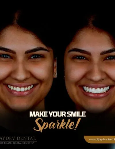 smile-makeover-before-after