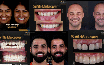 Why Choose Smile Makeover for Busy Professionals & NRIs?