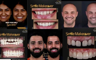 Why Choose Smile Makeover for Busy Professionals & NRIs?